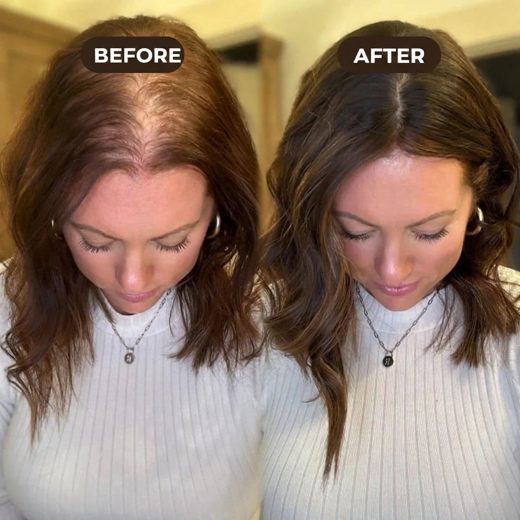 Batana Hair Oil — The Natural Solution for Hair Regrowth & Thickness