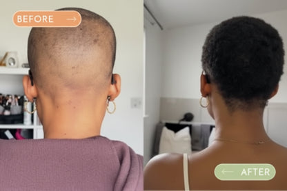 Batana Hair Oil — The Natural Solution for Hair Regrowth & Thickness